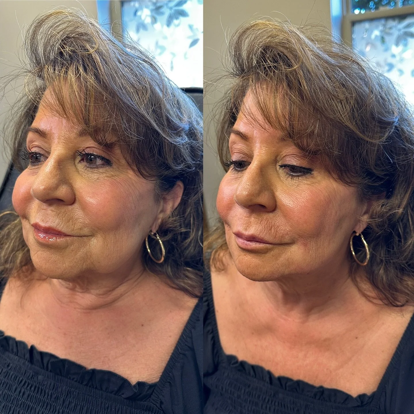 Facial balancing has been my fav thing lately! Her biggest concern was her lower face so we made everything nice smooth &amp; even down there since her cheeks were already gorgeous! 

#botox #filler #microneedling #jeuveau #laser #rha #evolus #dyspor