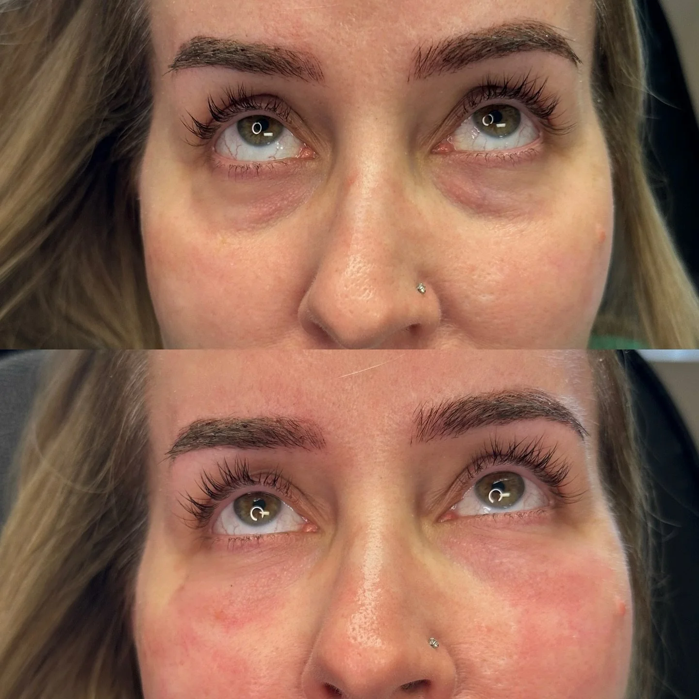 ✨ Bright eyes, no lies. Say goodbye to dark circles and hollowness with our powerful under-eye formula &ndash; because your eyes deserve to shine. 👁️ 🩸 
💼 Clinically tested. 🌿 Gentle on skin. 💡 Visible results.

➡️ Tap the link in bio to book yo