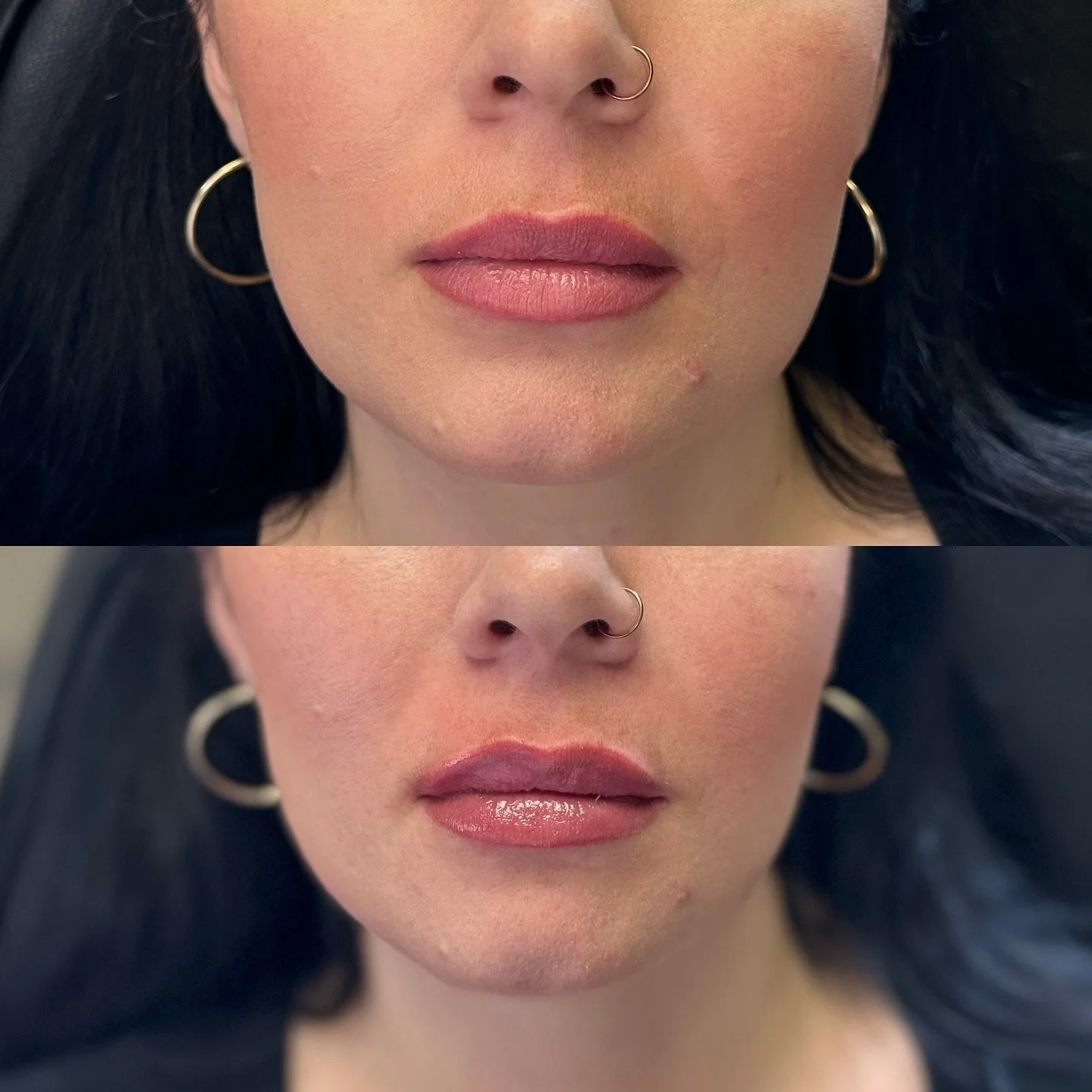 Made these gorgeous lippies more symmetrical 😍

#botox #filler #microneedling #jeuveau #laser #rha #evolus #dysport #juvederm #restylane #perfectdermapeel #penfield #versa #sculptra #beforeandafter #lipinjections #prp #aesthetics #medspa #neurotoxin