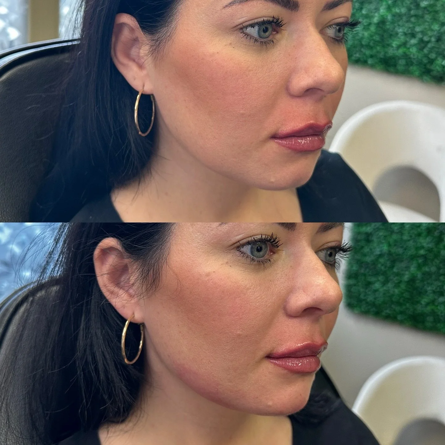 This year I&rsquo;m thankful for friends, family &amp; FILLER 🦃
Jawline, chin &amp; lip filler combo!!! 
Look how gorgeous and BALANCED she now looks 😍 
I&rsquo;m so obsessed with how this turned out 

☎️ 585-208-9151
click link below to book!

#bo