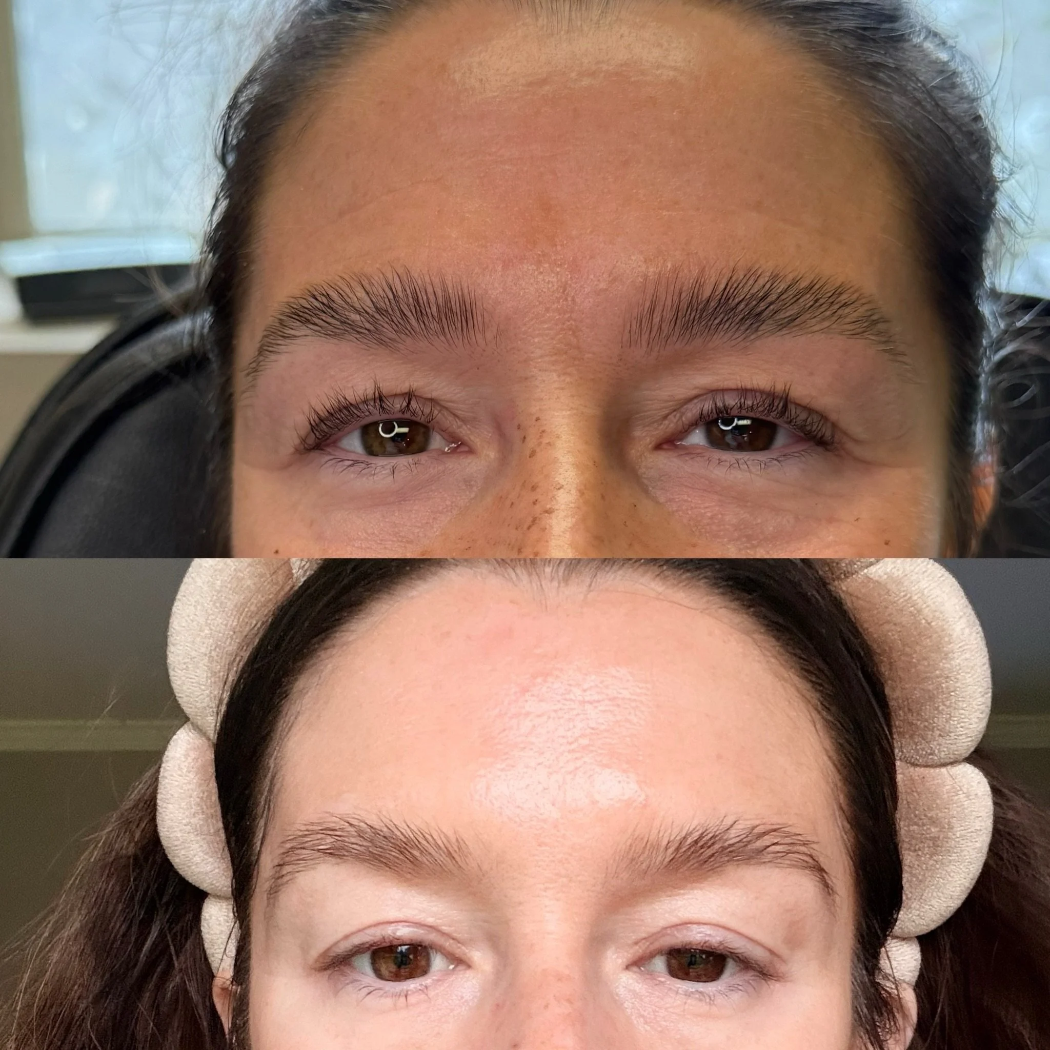 A lil brow lift !

Here we placed botox to her crows feet, glabella &amp; under the brow to help lift the eyelids. 

#botox #filler #medsparochester #lipfiller #rochesterny