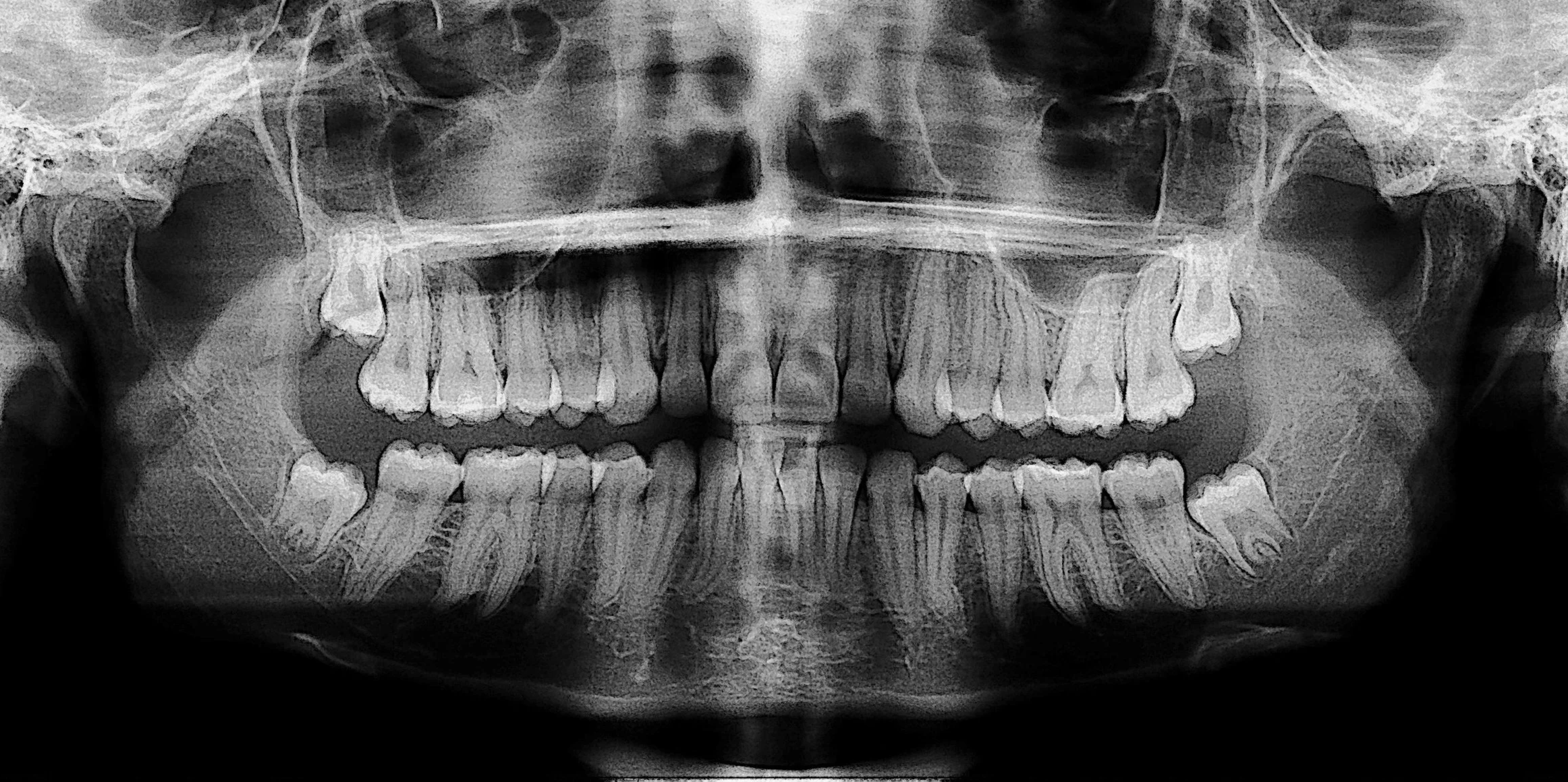 Altered States: An Experiment in Interactive Art Augmentation