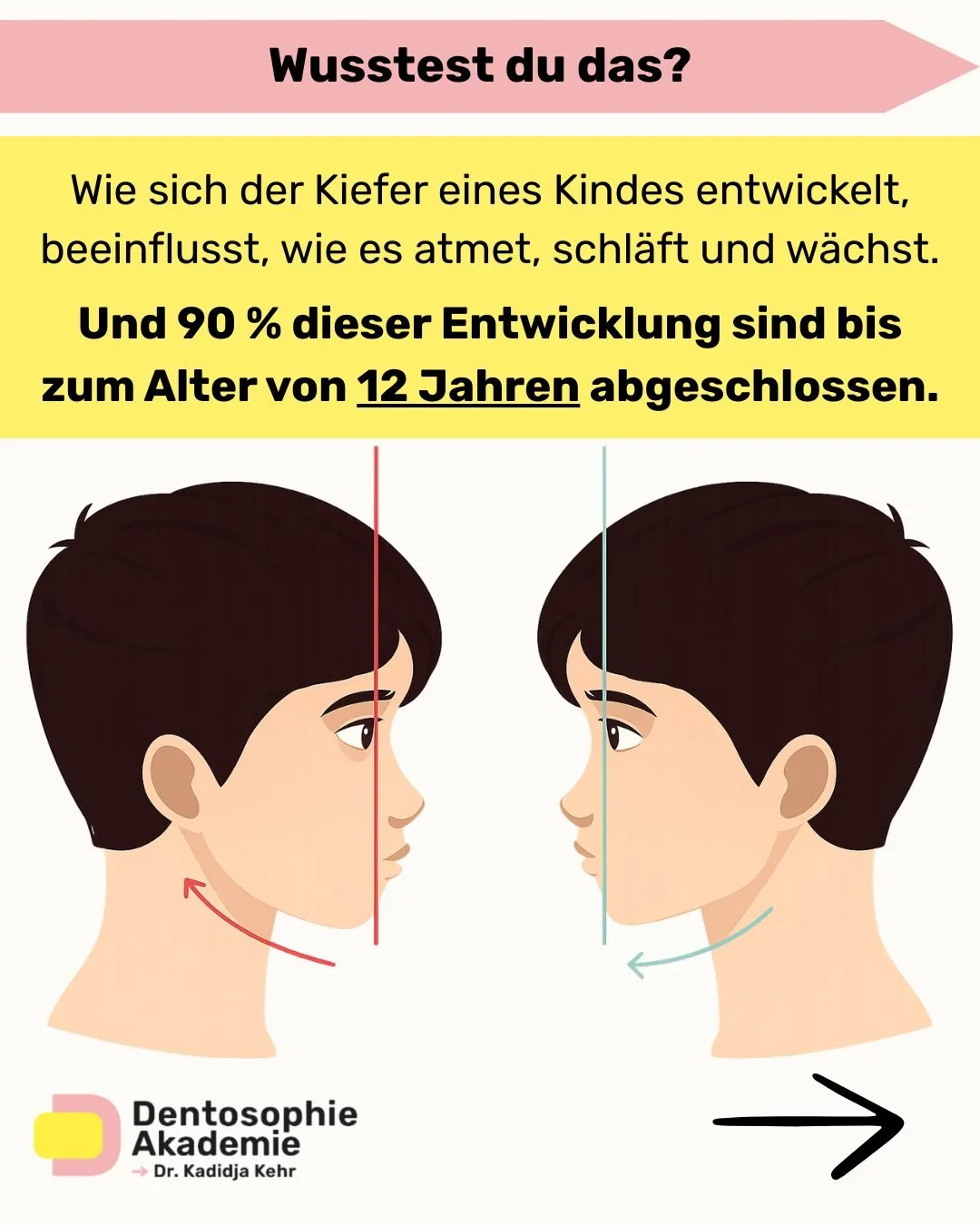 Kinder werden routinem&auml;&szlig;ig auf H&ouml;r- und Sehverm&ouml;gen untersucht, weil wir wissen, wie entscheidend diese Sinne f&uuml;r die Entwicklung sind.

Aber ihre Atemwege?
Die werden fast nie &uuml;berpr&uuml;ft.

Das Ergebnis?

Die meiste