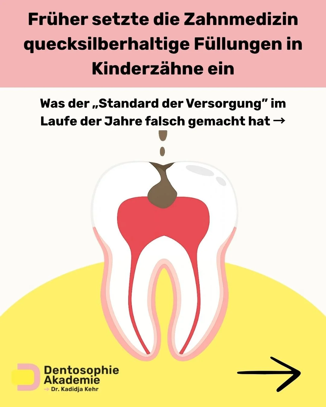 &Uuml;ber Jahrhunderte folgte die Zahnmedizin Ans&auml;tzen, die sich sp&auml;ter als unvollst&auml;ndig, ineffektiv oder sogar sch&auml;dlich herausstellten.
Was einst als &bdquo;Standard&ldquo; galt, wurde mit der Zeit hinterfragt.

Im 18. Jahrhund
