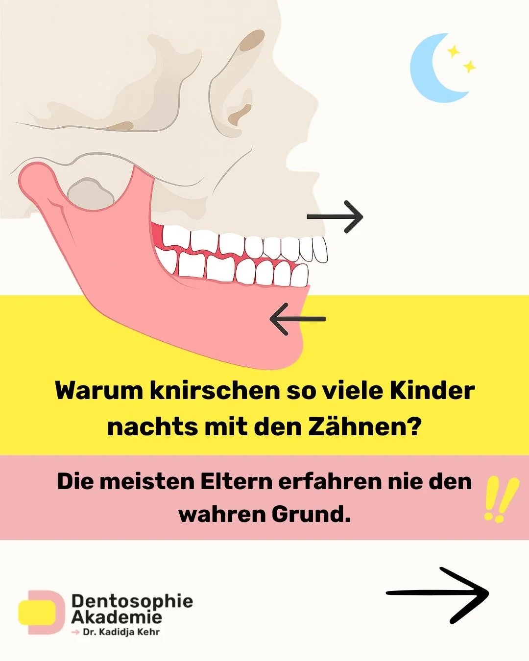Wenn Kinder nachts mit den Z&auml;hnen knirschen, ist das oft kein Zufall, sondern ein Zeichen daf&uuml;r, dass der K&ouml;rper versucht, die Atemwege offen zu halten.

Wird die Atmung im Schlaf eingeschr&auml;nkt, reagiert das Nervensystem automatis