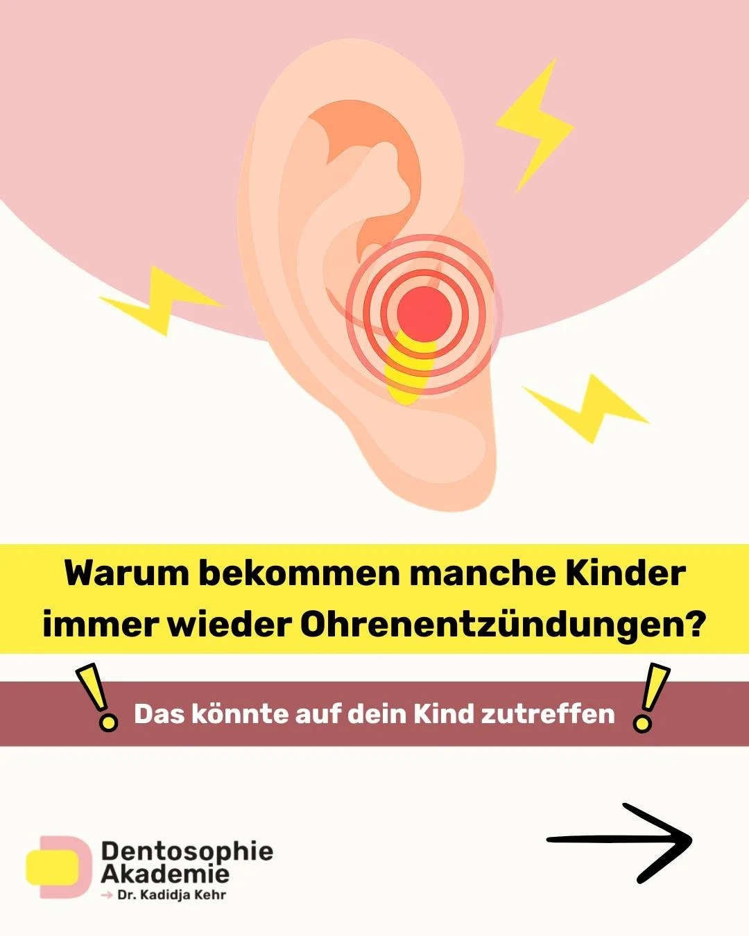 Die meisten Kinder, die mit wiederkehrenden Mittelohrentz&uuml;ndungen vorgestellt werden, haben bereits die &uuml;blichen Empfehlungen erhalten: Antibiotika, Paukenr&ouml;hrchen oder eine Adenotomie.

Und trotzdem kehren die Beschwerden h&auml;ufig 