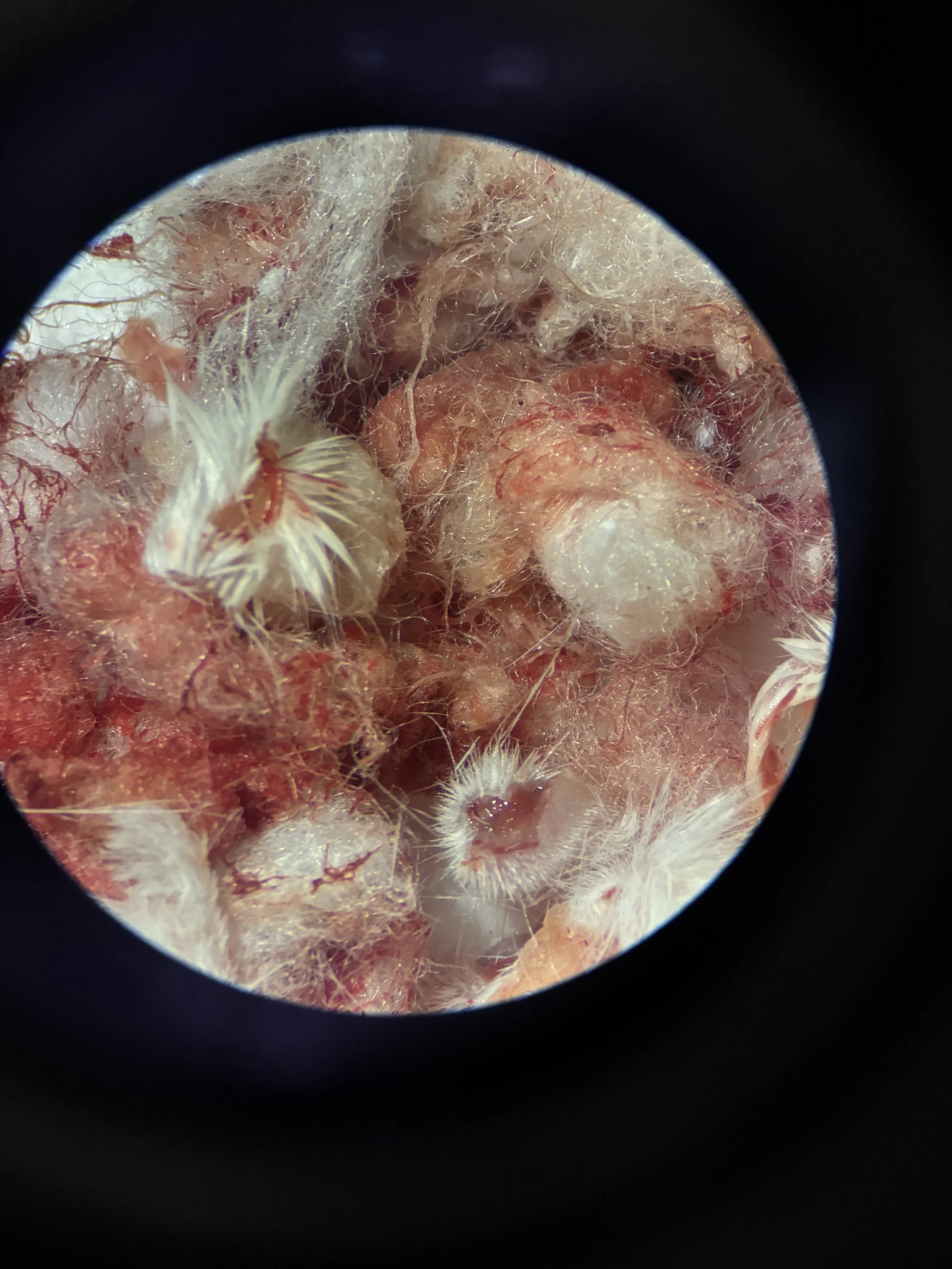 Cotton Balls After c57 Kidney Dissection