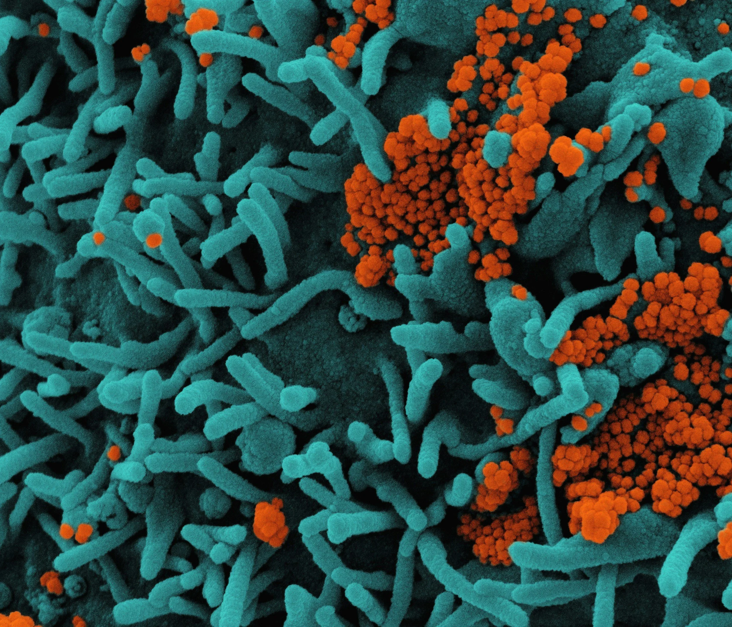 Impact of psilocybin and Psilocybe cubensis extract on gut microbiota in Wistar Han rats