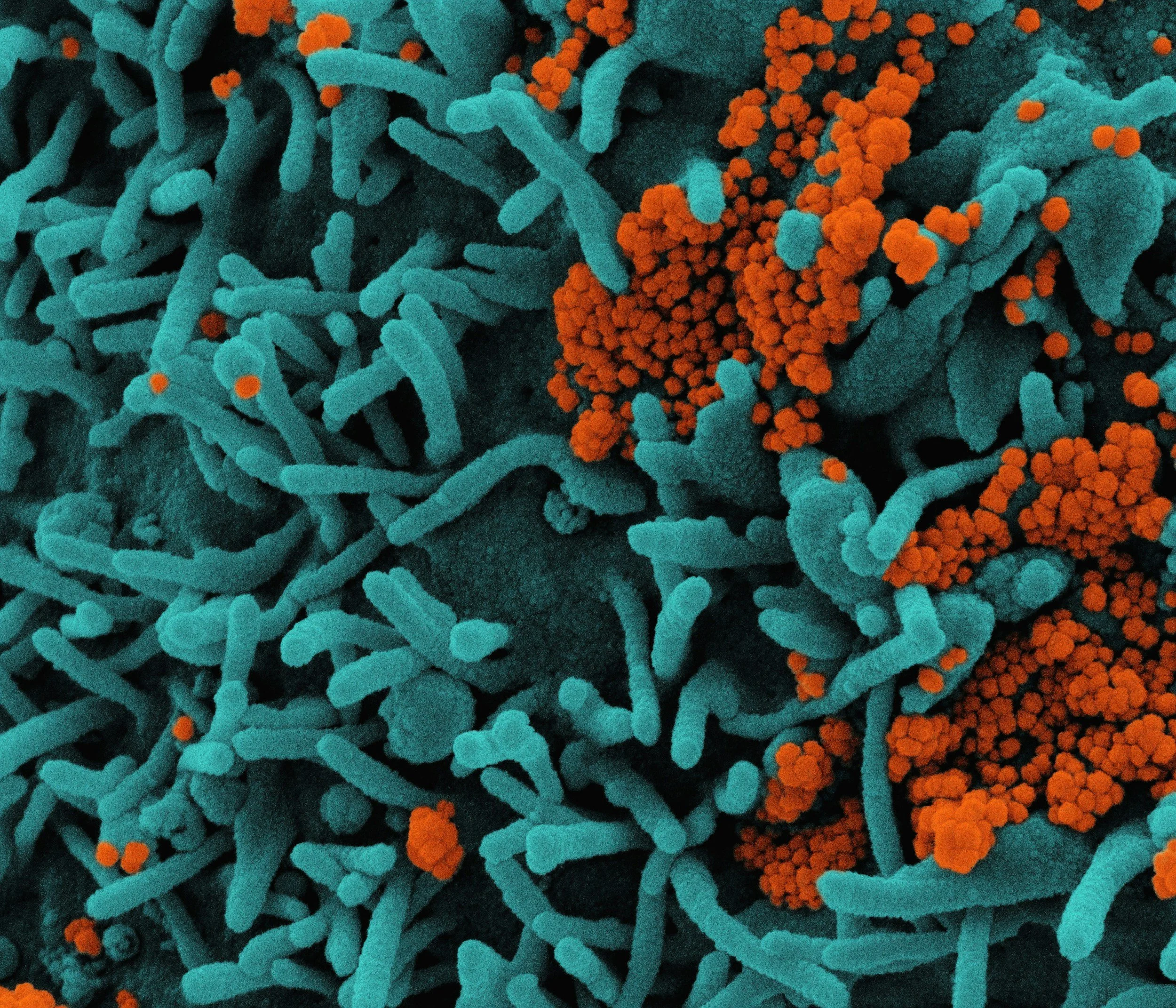 Effects of an international ceremonial ayahuasca retreat on the diversity and community composition of the human gut microbiome: A preliminary observational single-arm pre-post study