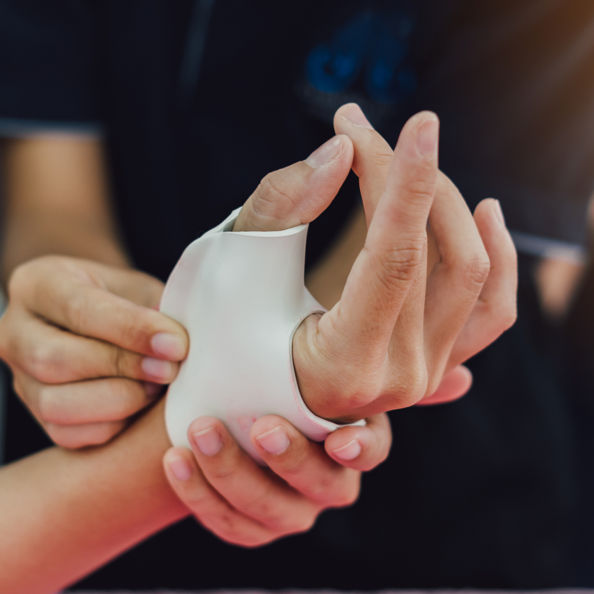 Occupational therapist fitting a hand splint to support upper limb and hand function rehabilitation