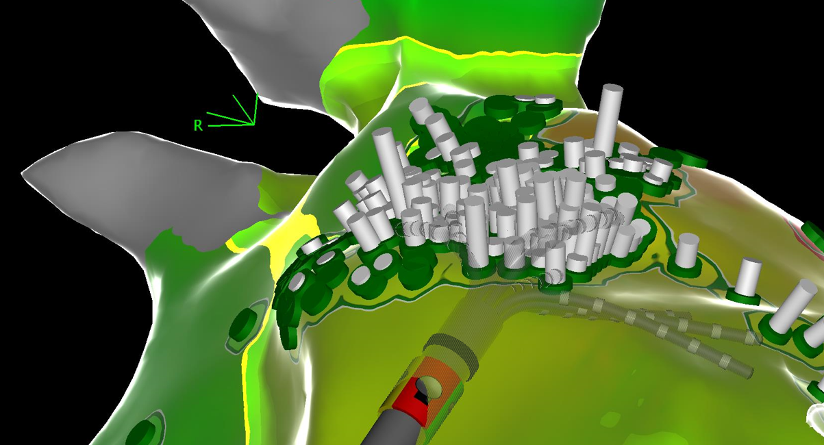 3D-Modell einer Stadt mit Gebäuden, Straßen und Landschaftsmerkmalen in Grüntönen, mit technischer Zeichnung