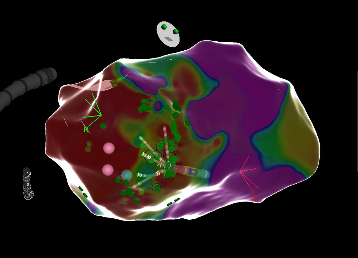 Computer-generiertes 3D-Diagramm eines Körpers mit farbigen Flächen, Markierungen, Pfeilen, einer Röhre auf der linken Seite und einem humanoiden Kopf oben.