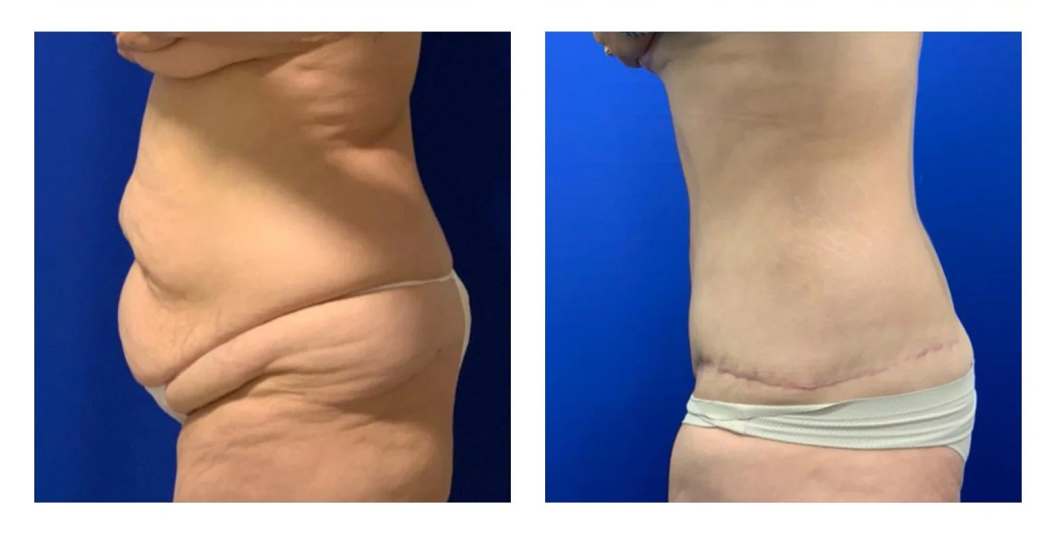 body2.jpg