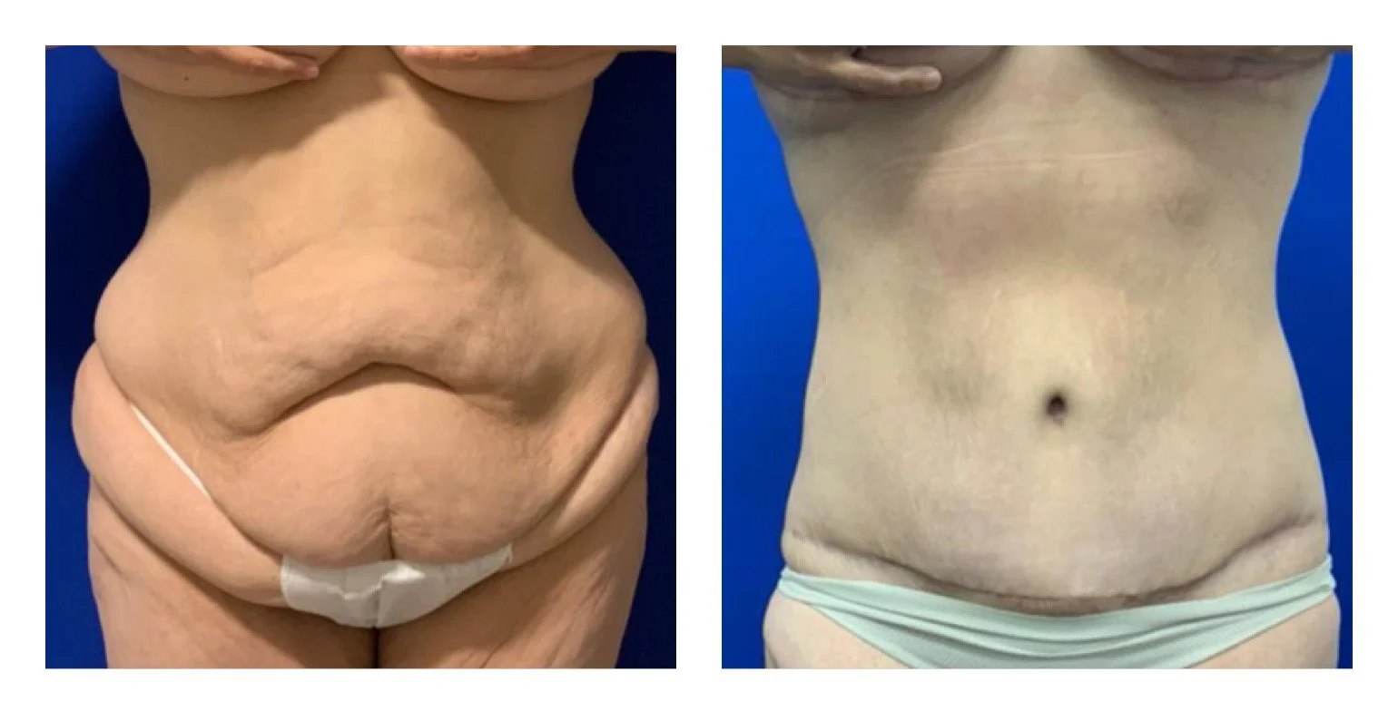 Body 1.jpg