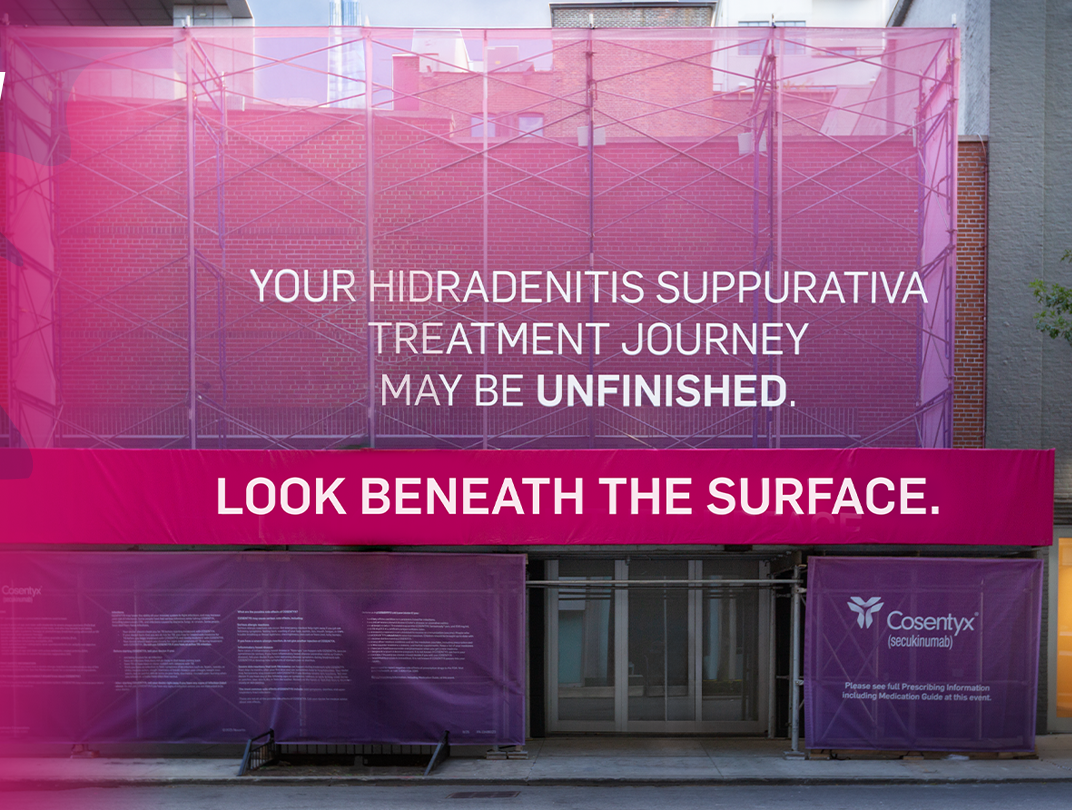 Beneath the Surface