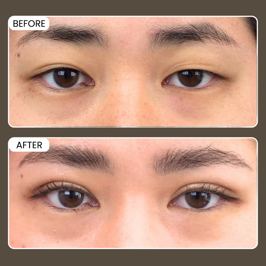 Close-up of a person's eyes, showing a before and after comparison. The 'before' image shows slightly drooping eyelids and less defined eyelashes. The 'after' image shows lifted eyelids and more defined eyelashes, indicating a cosmetic or skincare im