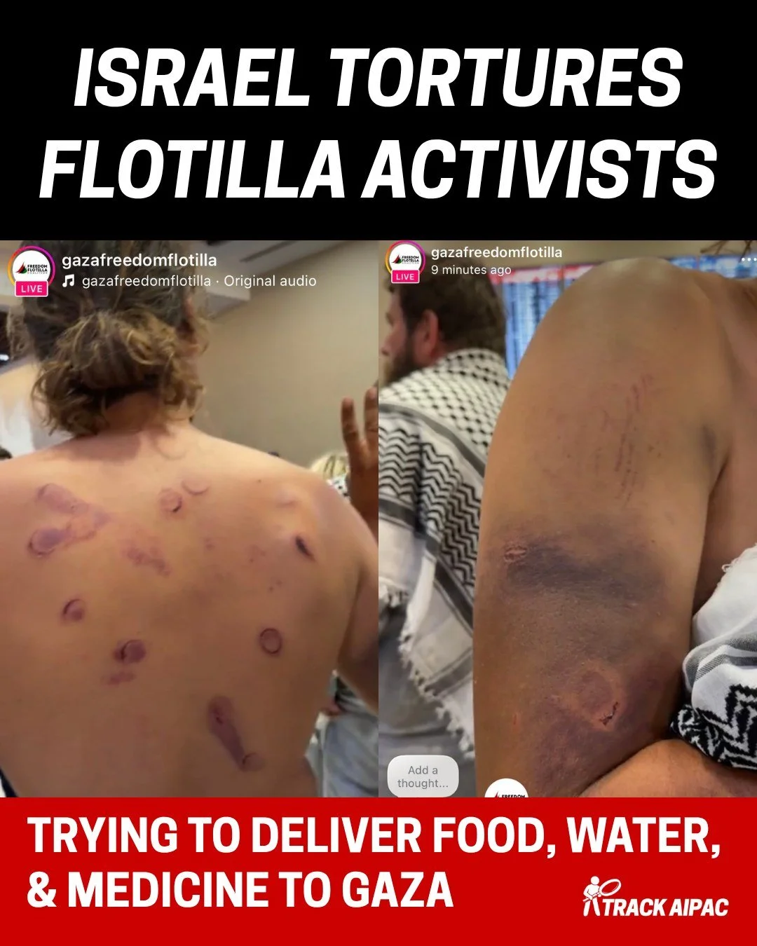 The world just watched Israel&rsquo;s fascist National Security Minister publicly mock humanitarian activists after they were brutalized in Israeli custody.

Itamar Ben-Gvir posted videos of himself tormenting, taunting, and laughing at flotilla acti