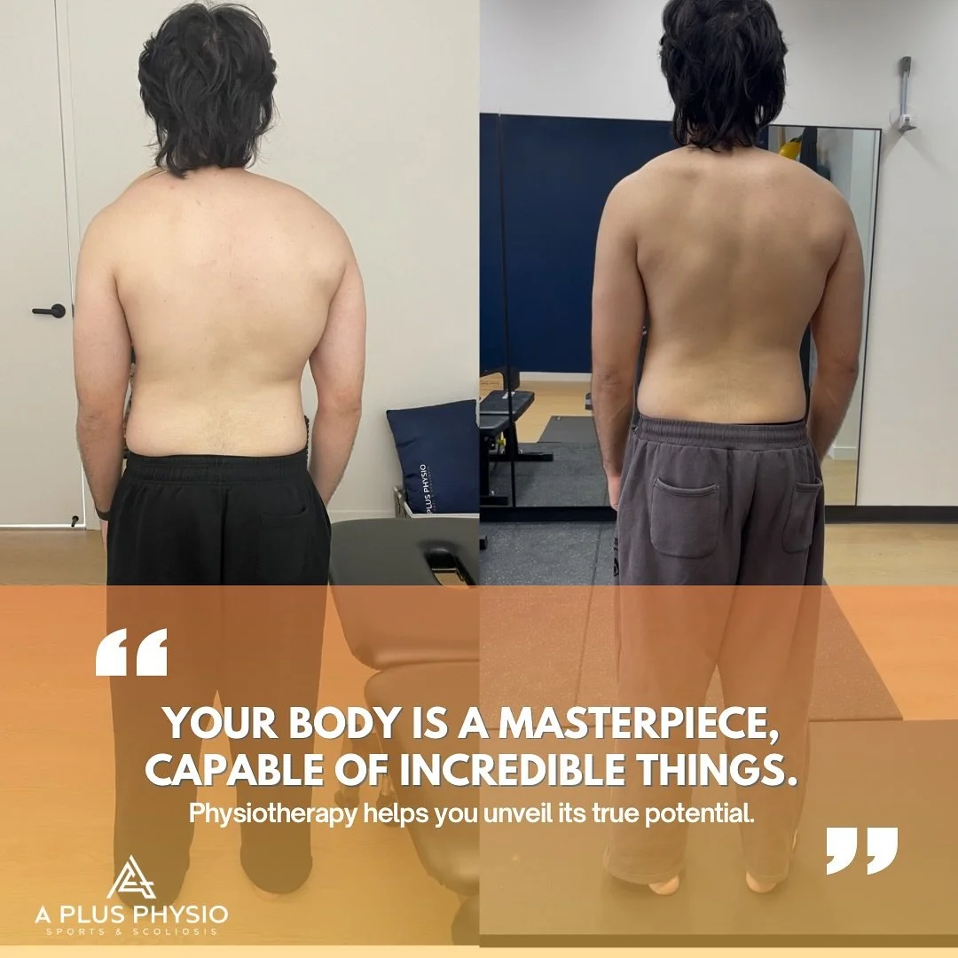 Notice the difference? This incredible before-and-after speaks volumes about effective physiotherapy! 

The image on the left shows common postural challenges, while the right showcases the fantastic improvements achieved through our tailored treatme