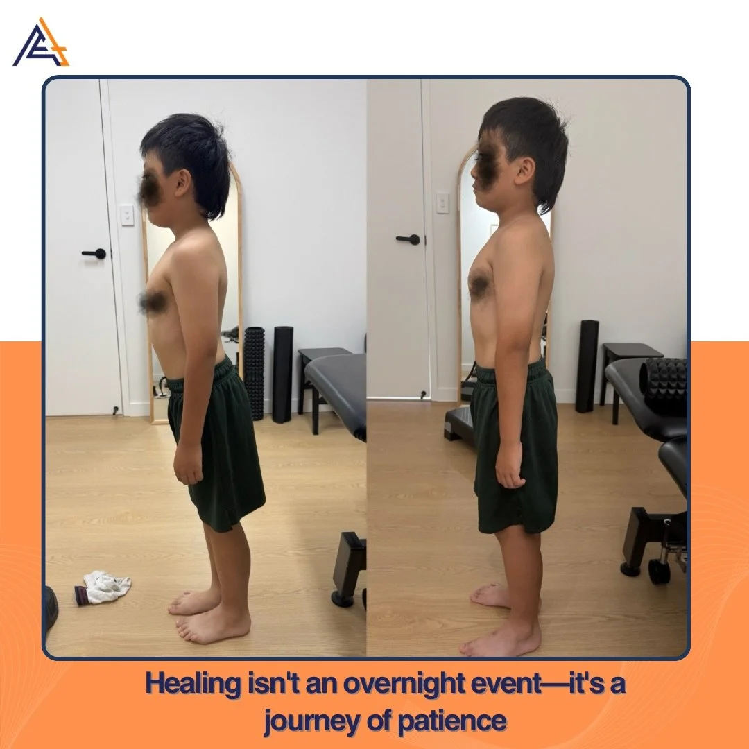 Scoliosis management is a marathon, not a sprint. 🏃&zwj;♂️💨

It&rsquo;s easy to get discouraged when you don&rsquo;t see changes day-to-day, but when we look back at the starting point, the transformation is undeniable. Improved posture isn&rsquo;t
