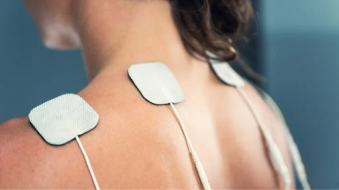 Back of a person with electrotherapy pads attached to their shoulder for muscle stimulation.