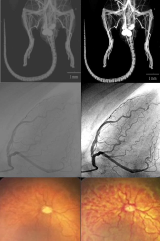 AI applications in medical imaging and MedTech.