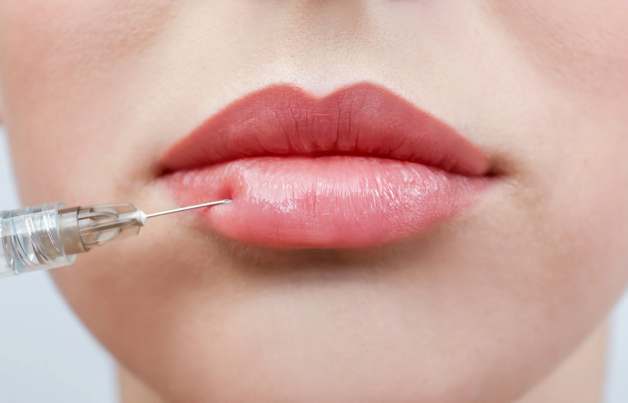 Aesthetics Treatments- Lip injections, botox, biostimulators, PDO thread lift