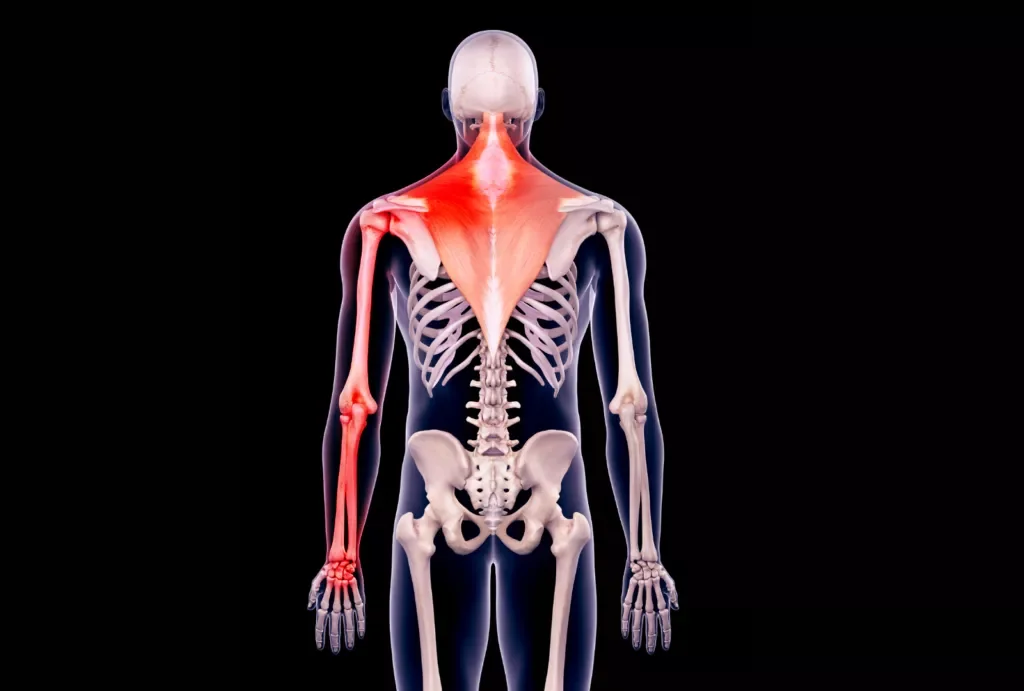 What Neck Injury Causes Arm Pain?