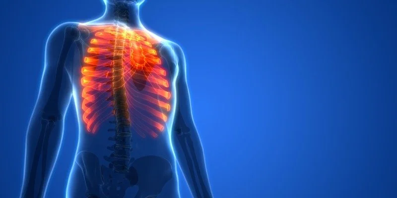 What Is Flail Chest After an Accident and Is It Life Threatening?