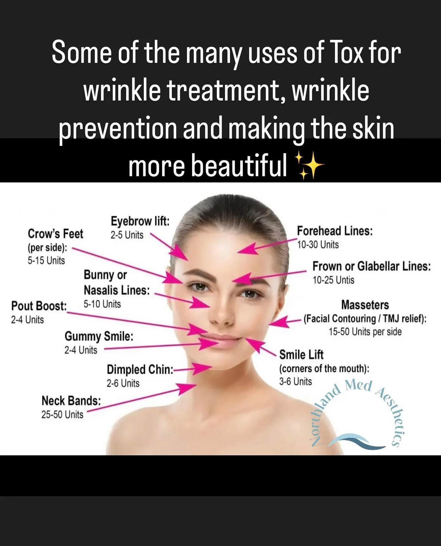 ✨ Neurotoxin isn&rsquo;t just for softening wrinkles &mdash; it&rsquo;s one of the most versatile treatments in aesthetics! From smoothing fine lines and preventing new ones to creating a refreshed, radiant look, it&rsquo;s a simple step toward more 