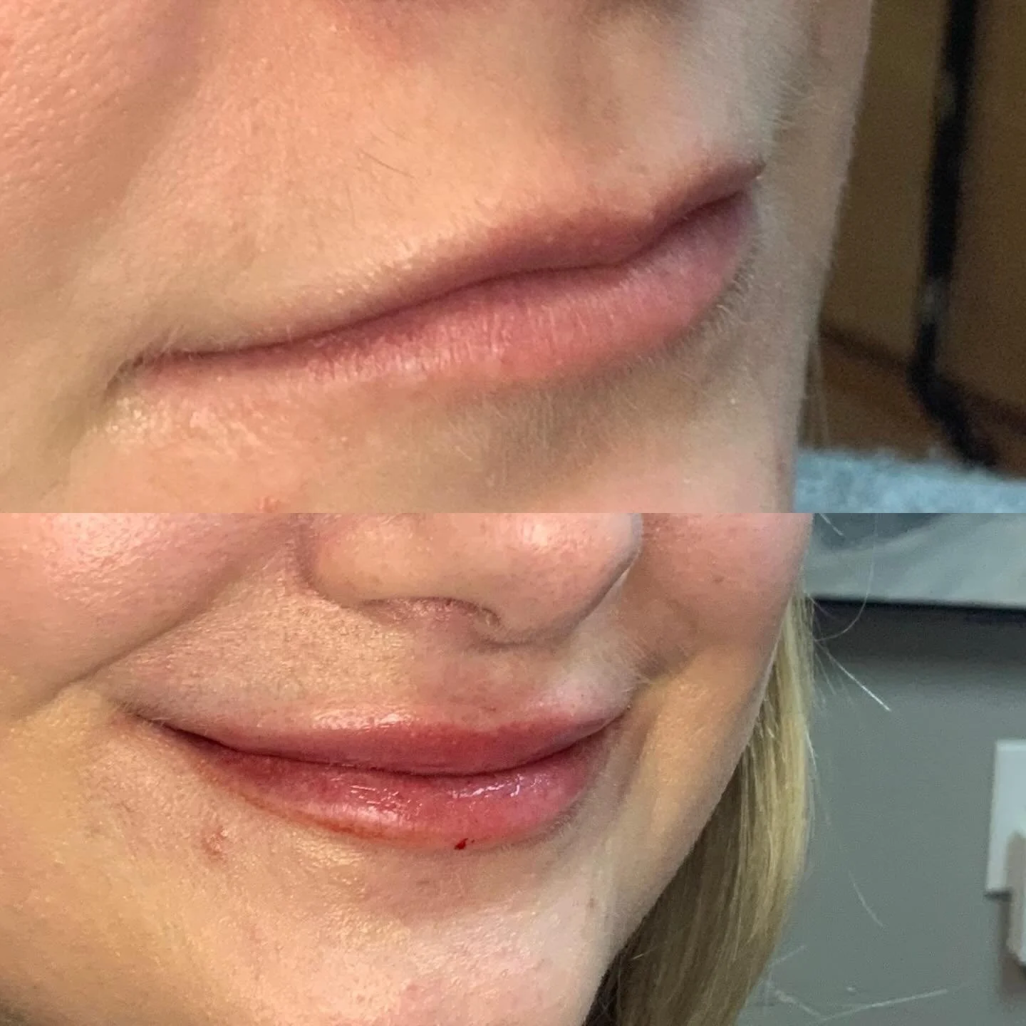 Lips, done well 💋

The best lip filler isn&rsquo;t obvious.
It&rsquo;s balanced. Soft. Natural-looking.

At Northland Med Aesthetics, we focus on:
✨ Enhancing your natural shape
✨ Restoring subtle volume
✨ Smoothing fine lines
✨ Keeping lips proport
