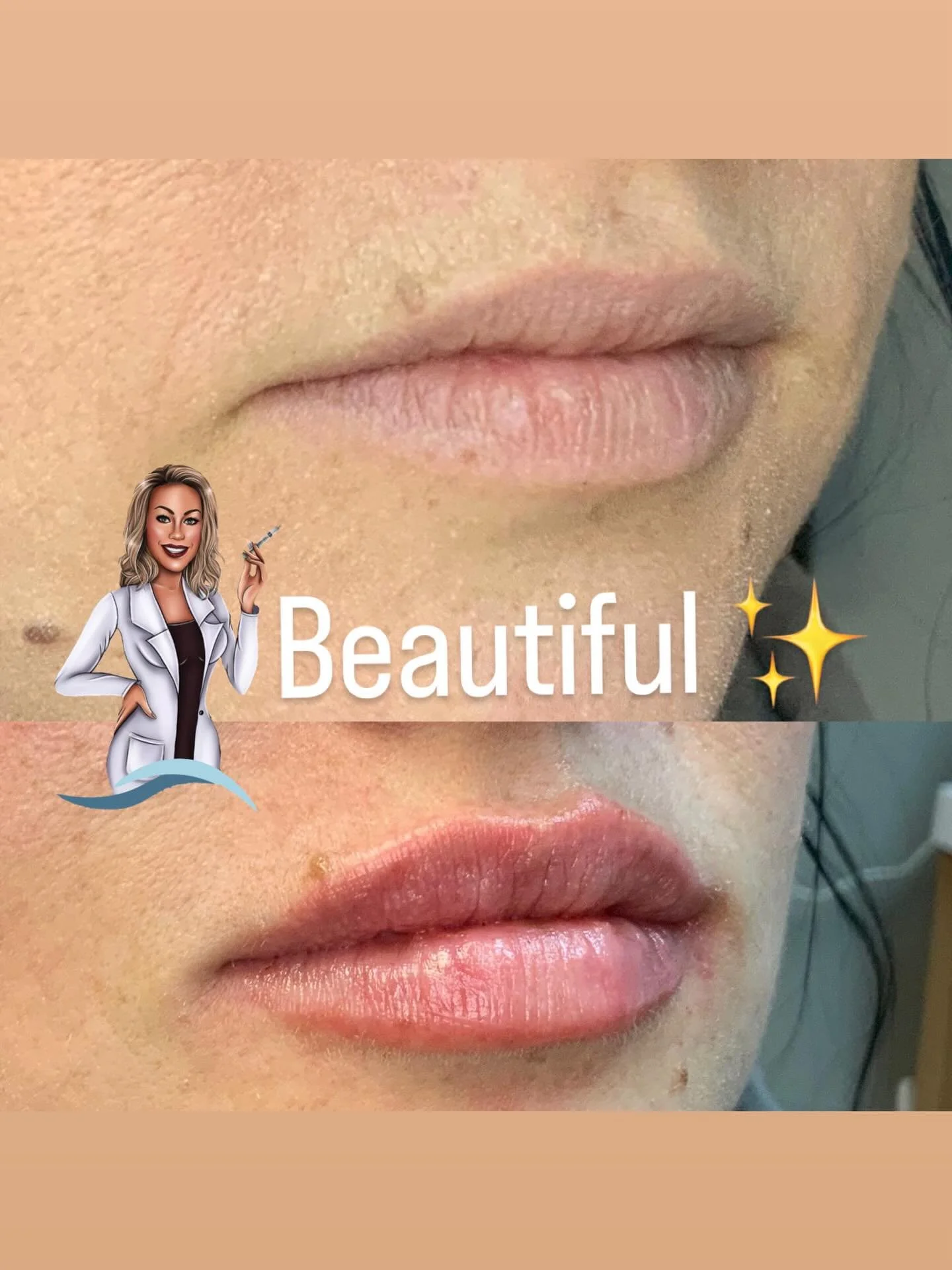 Lips are one of the most unique features on the face&mdash;no two are exactly the same. Shape, balance, movement, and proportion all play a role in what makes them beautiful. My approach is never about creating identical lips, but about enhancing wha