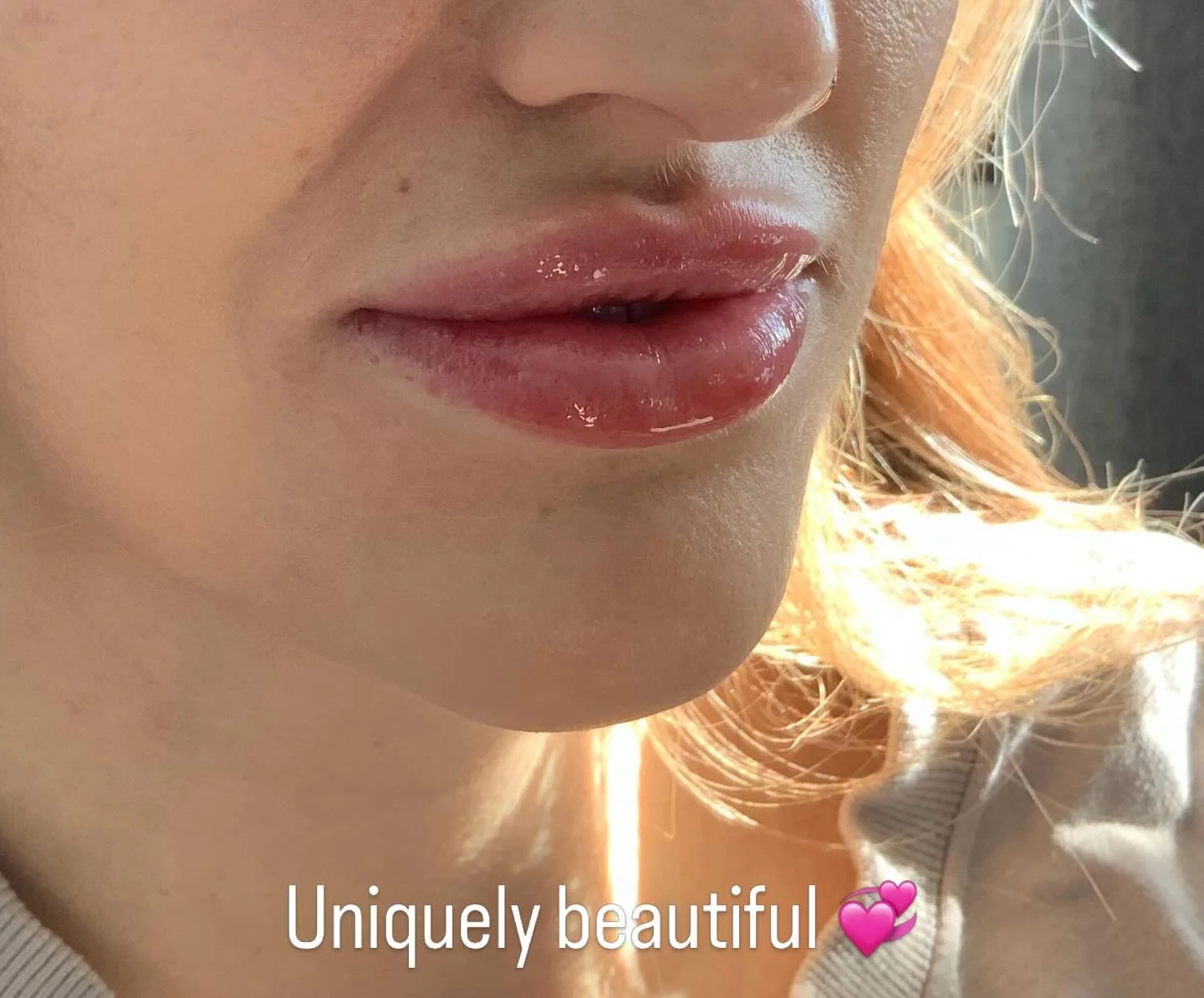 Another day another uniquely beautiful set of lips 💙