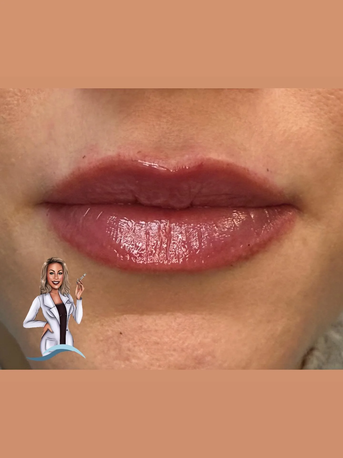 Another set of perfectly unique and beautiful lips. 👄 At Northland Med Aesthetics we value each patients uniqueness and believe THAT is what is beautiful 💞