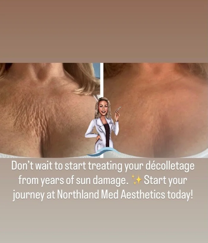 Your face isn&rsquo;t the only place that tells your story&hellip; ✨

The d&eacute;colletage is one of the first areas to show aging&mdash;think sun damage, crepey texture, and fine lines&mdash;yet it&rsquo;s often the most overlooked.

And here&rsqu