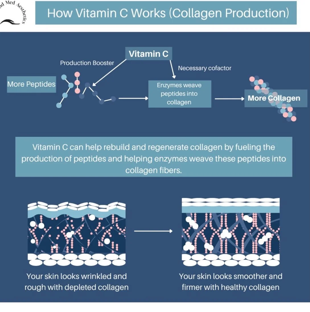 Our Vitamin C Brightening Pads at Northland Med Aesthetics are one of the easiest ways to support brighter, healthier skin while helping fuel collagen production. ✨

Vitamin C is a necessary cofactor your skin uses to help build and strengthen collag