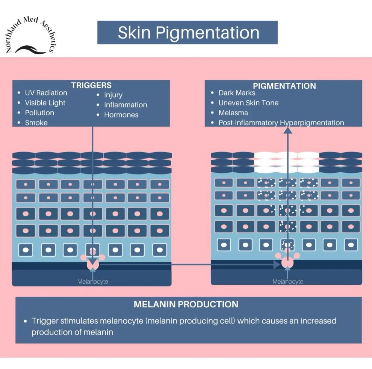 Pigmentation is complex &mdash; and so is treating it. ☀️

Triggers like UV radiation, visible light, hormones, inflammation, heat, and injury can stimulate melanocytes (our pigment-producing cells), leading to:
&bull; Sun spots
&bull; Uneven skin to