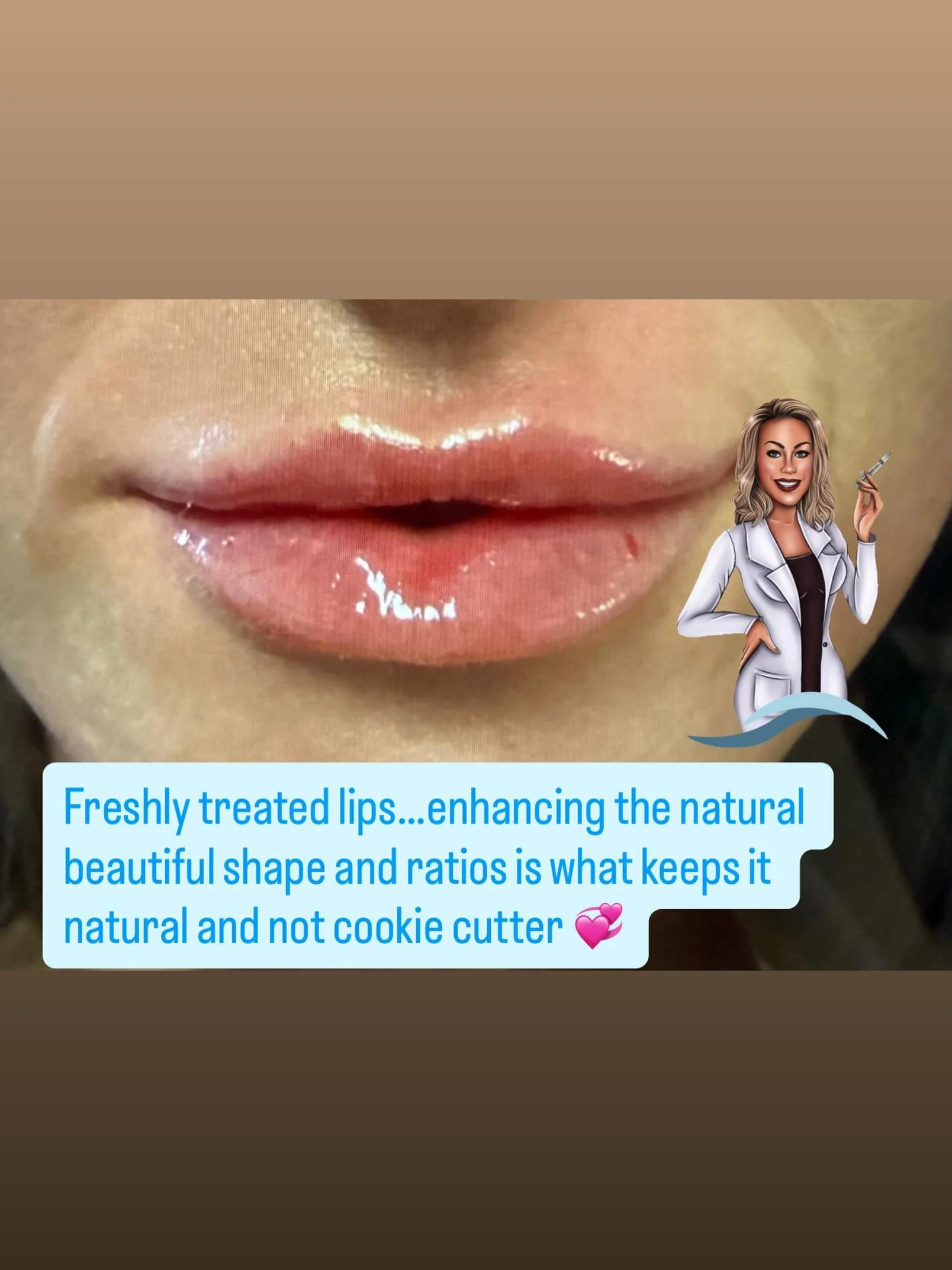 Fresh lips, tailored to your anatomy 💋
The goal isn&rsquo;t &ldquo;bigger&rdquo; &mdash; it&rsquo;s balance, structure, hydration, and enhancing the shape you already have. Subtle details make all the difference ✨

At  Northland Med Aesthetics￼, eve