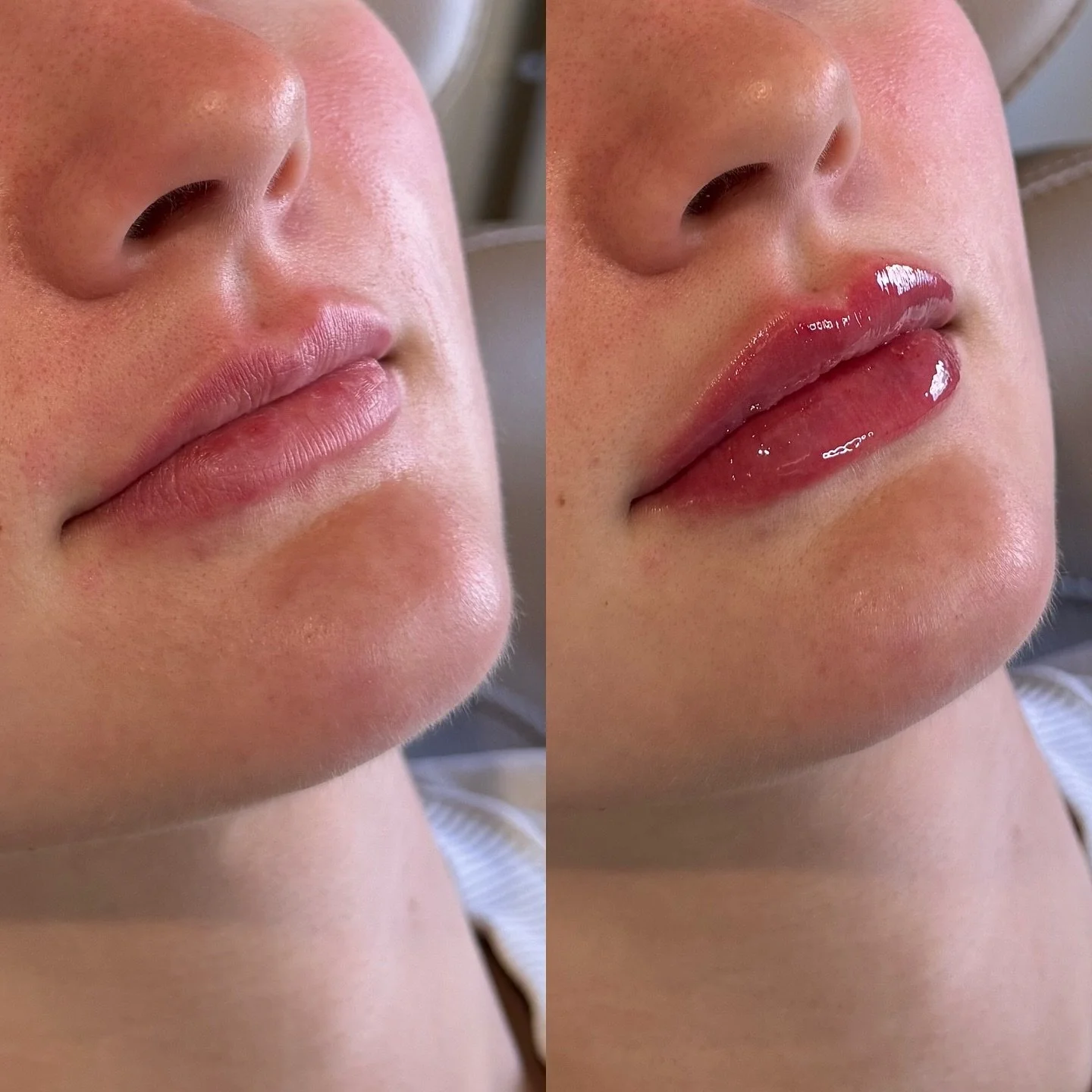 It&rsquo;s been a minute since I shared a before &amp; after 🤎 a beautiful lip for a beautiful girl 💌