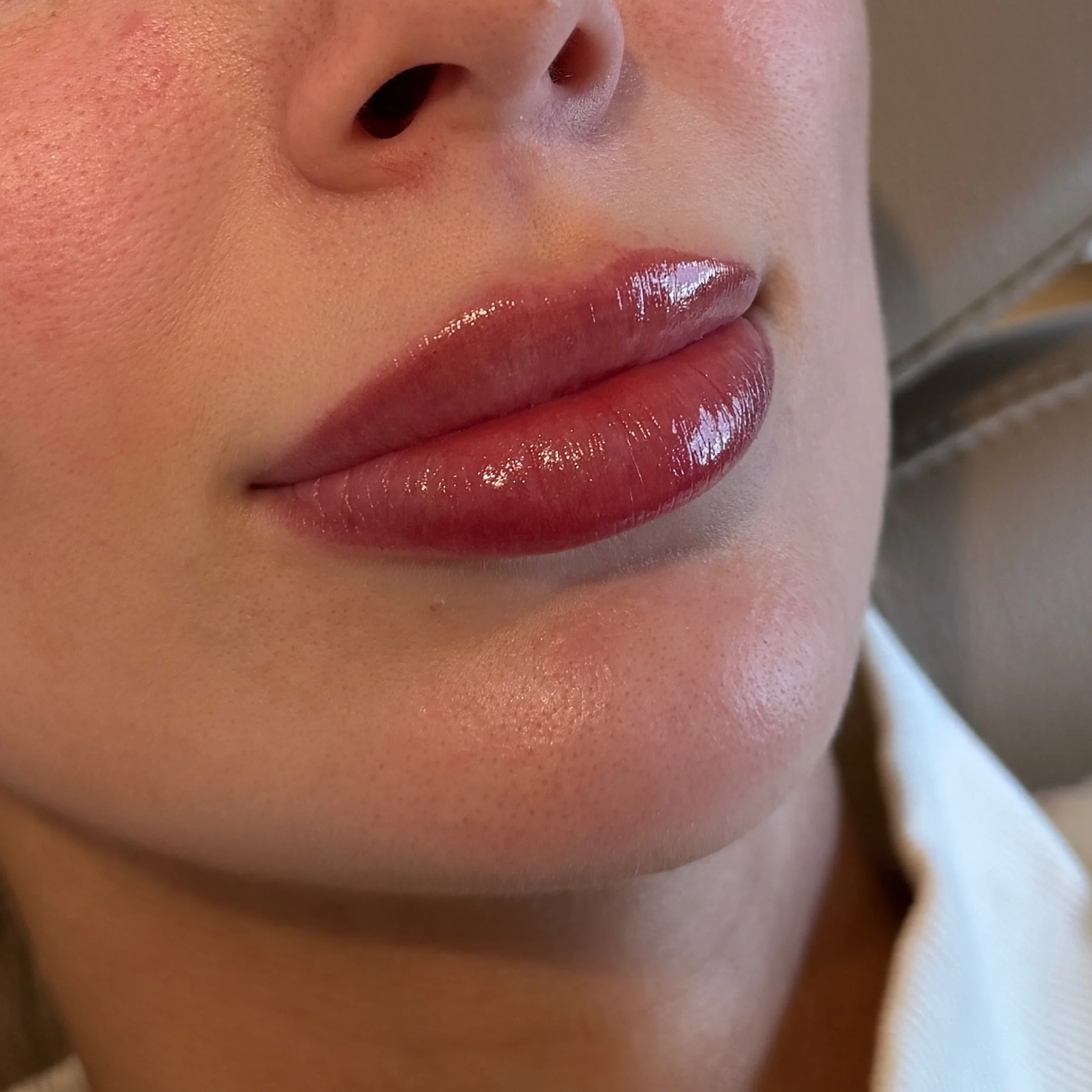 A beautifully healed Muse lip 🤎

𝐎𝐧𝐥𝐢𝐧𝐞 𝐁𝐨𝐨𝐤𝐢𝐧𝐠 𝐀𝐯𝐚𝐢𝐥𝐚𝐛𝐥𝐞 | link in bio 
𝐖𝐞𝐛𝐬𝐢𝐭𝐞 | www.museaestheticsco.com
𝐋𝐨𝐜𝐚𝐭𝐢𝐨𝐧 | Arch Salon &amp; Suites North Loop Minneapolis