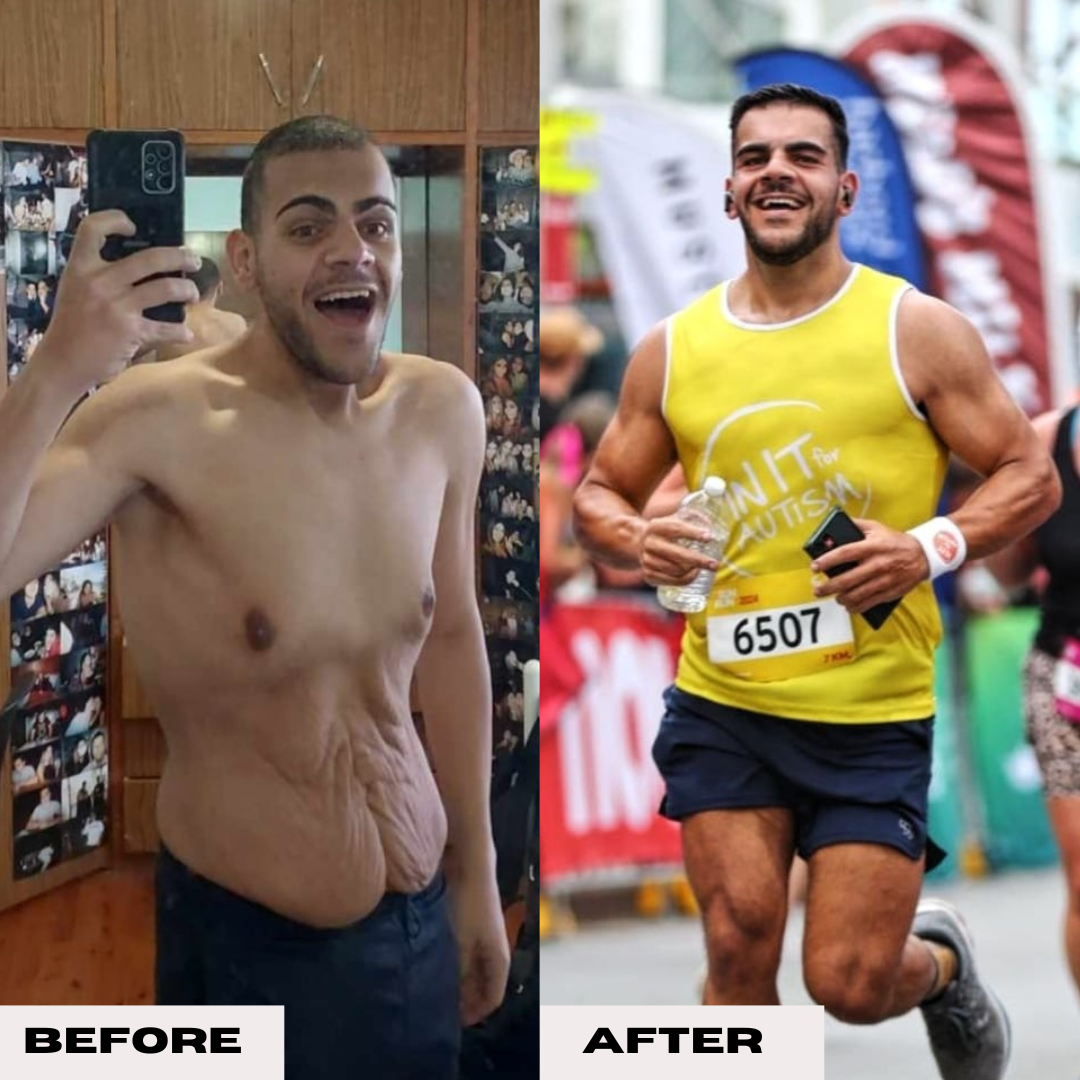 Before & Afters (7).png