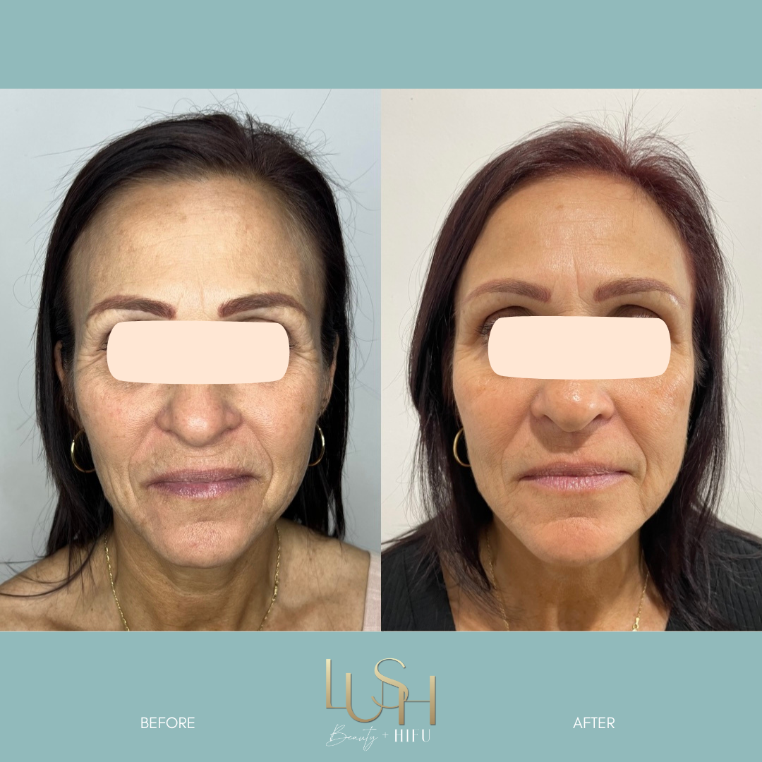 Editable Templates pics.zip - 2.PNG