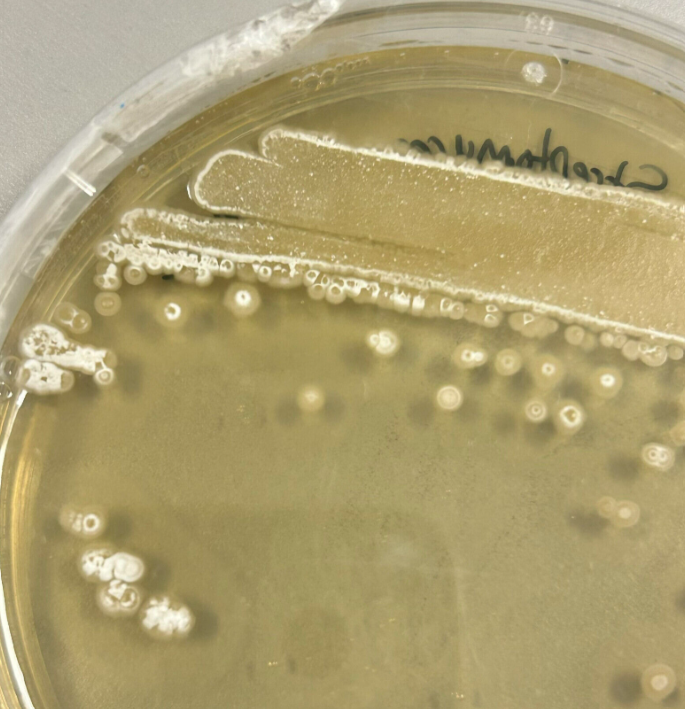 A petri dish with bacterial culture