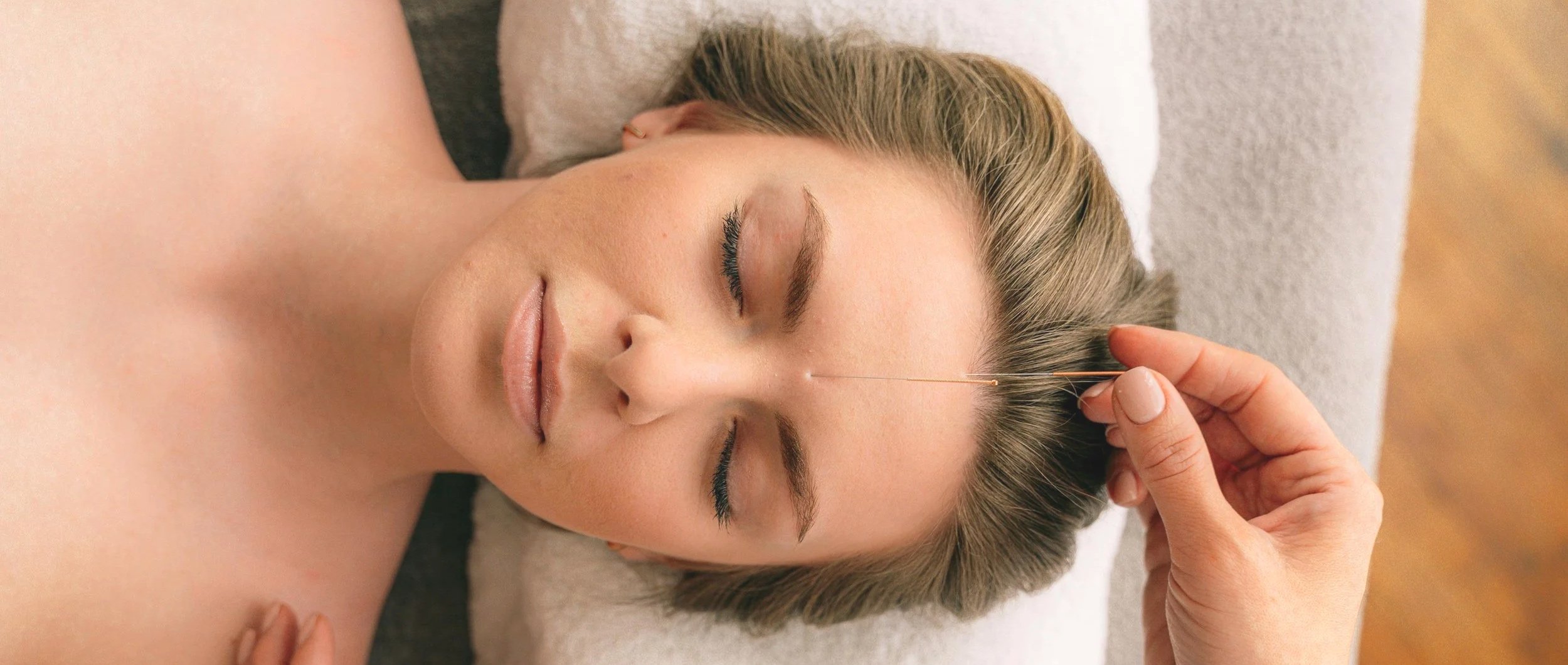 Glow From the Inside Out: Facial Rejuvenation Acupuncture