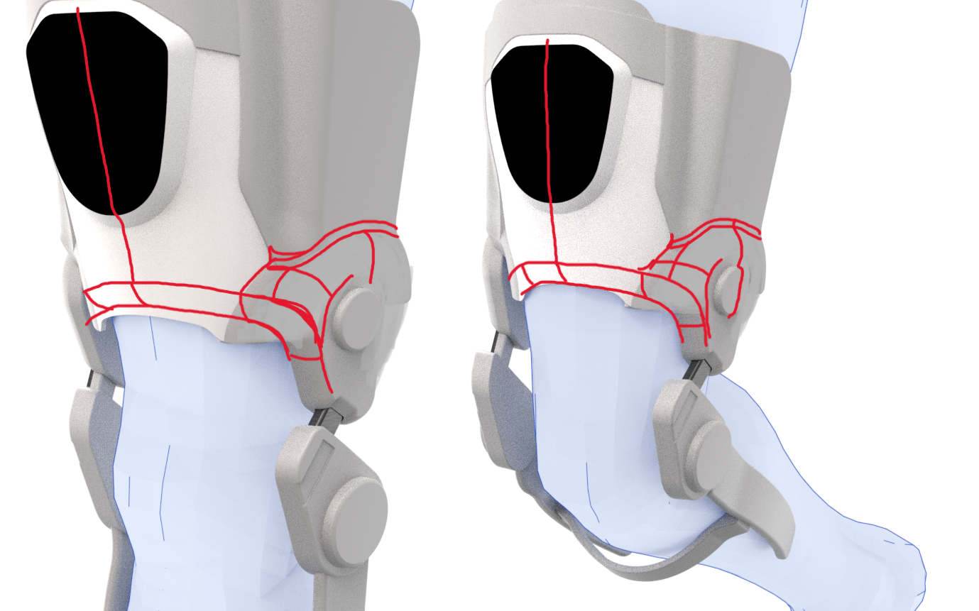 PASSION PROJECT- Medical Devices