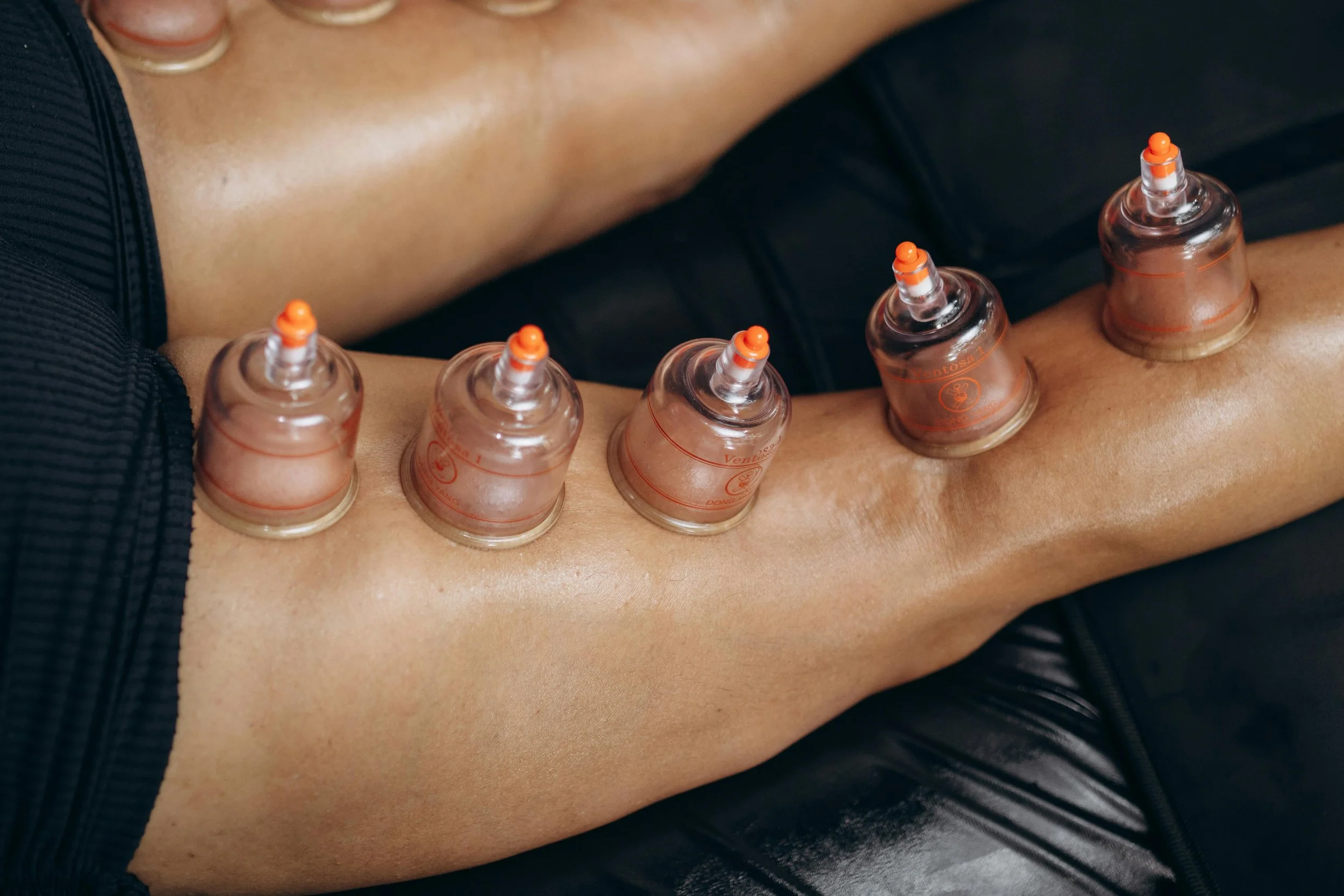 How Cupping Therapy Can Enhance Recovery After Long Runs
