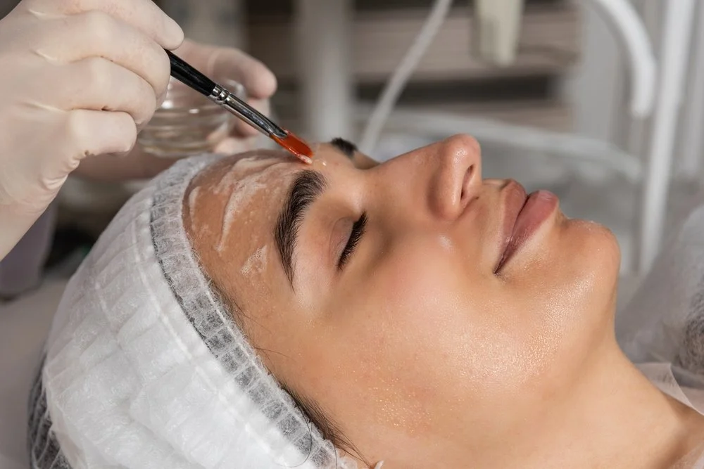 Chemical peel the beauty clique brighton best medical spa livingston county dr brittany eidson jessica adams