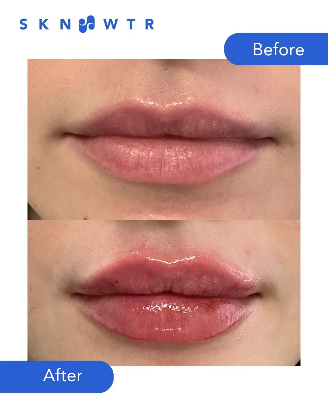 @face_byrachael 

Perfect volume. Refined structure. Signature SKN WTR results.