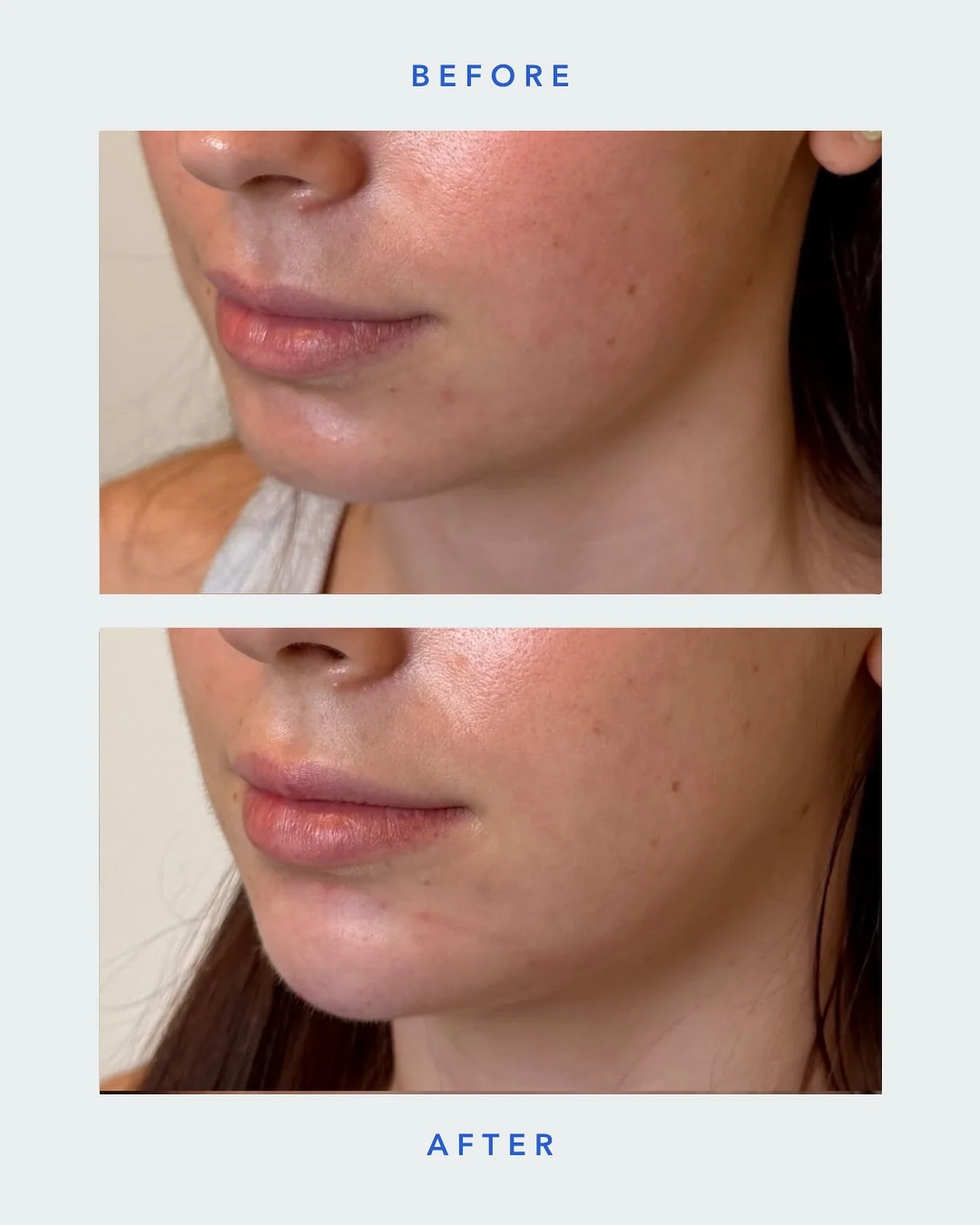 Still you. Just refreshed.

SKN WTR
📍Arsenal Yards Blvd-D133 Watertown, MA 02472
📱(617) 214-3688
💻 www.sknwtr.com

-
-
-
-
#skinenhancement #skinspaboston #enhancement #bostonmedspa #bostonfacialspa #beforeandafter #beforeandafterfacialbalancing