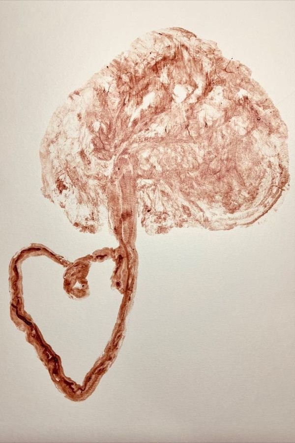 Impressão da placenta