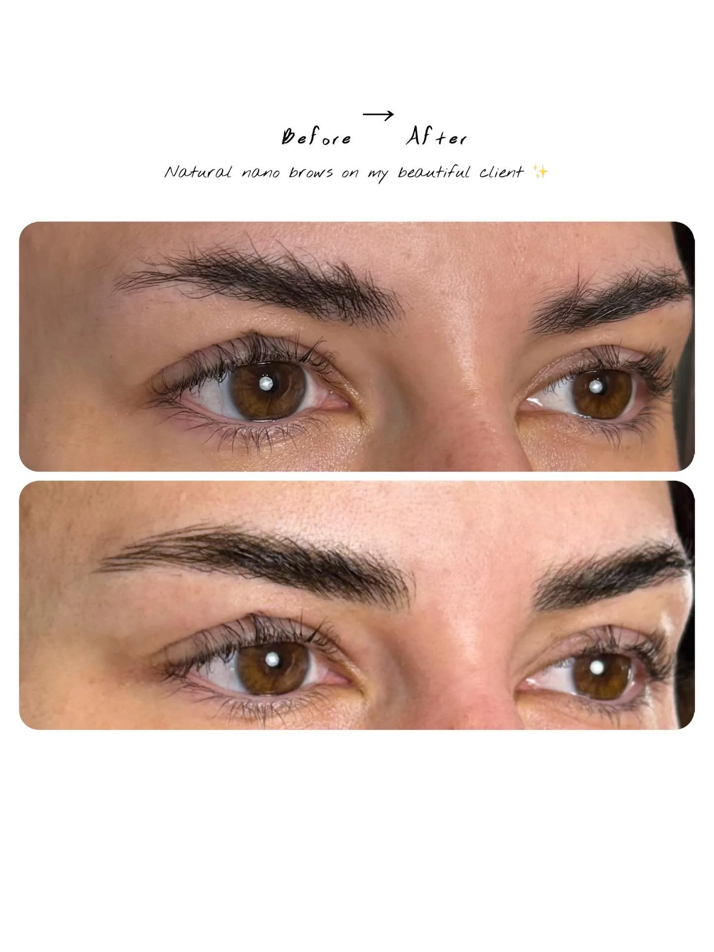 A little structure can make a big difference. 🖌️

For this set, the goal was simple:
Balanced &bull; Natural &bull; Defined

Nano strokes allow us to fill sparse areas while keeping the brows soft and realistic.

#nanobrows #pmuartist #browartist #p